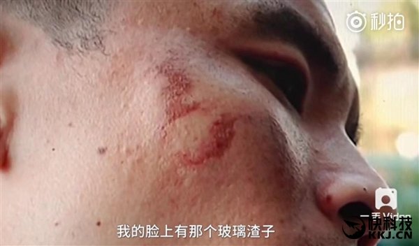 Apple берет пример у Samsung? Теперь один за другим взрываются iPhone - Изображение 1 Apple берет пример у Samsung? Теперь один за другим взрываются iPhone - Изображение 1